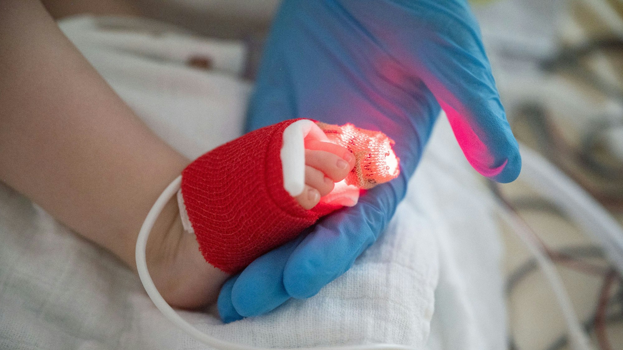 Eine Intensivpflegerin hält auf der Kinder-Intensivstation in einer Klinik den Fuß eines jungen Patienten, der beatmet wird, in der Hand.