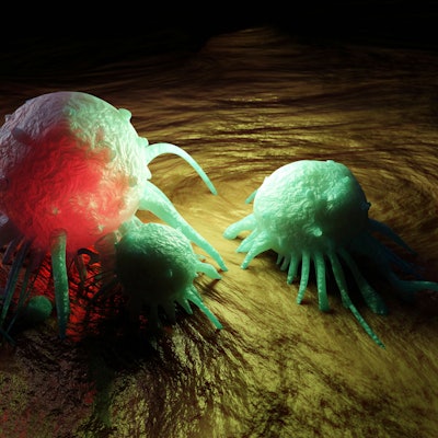 Eine 3D-Ansicht einer Krebszelle im menschlichen Körper