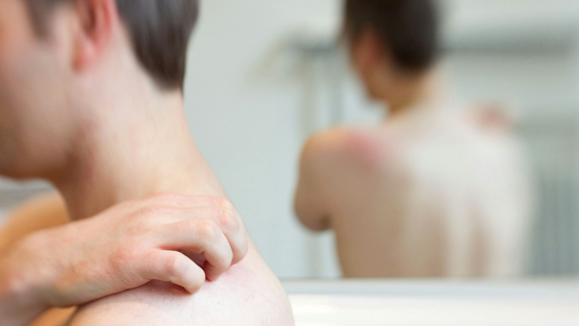 Ein Mann kratzt sich an der Schulter.