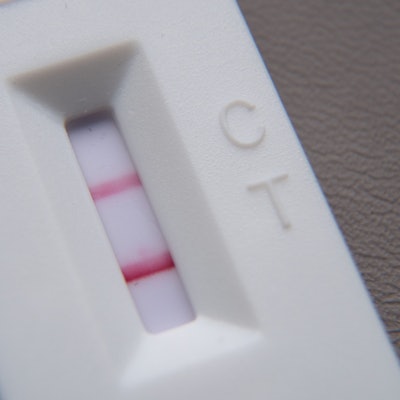 ARCHIV - 17.01.2022, Hessen, Frankfurt/Main: Ein positiver Corona-Schnelltest liegt auf einem Tisch. (zu dpa: "Studie: Bis Ende 2021 jeder zehnte Erwachsene mit Corona infiziert") Foto: Sebastian Gollnow/dpa +++ dpa-Bildfunk +++