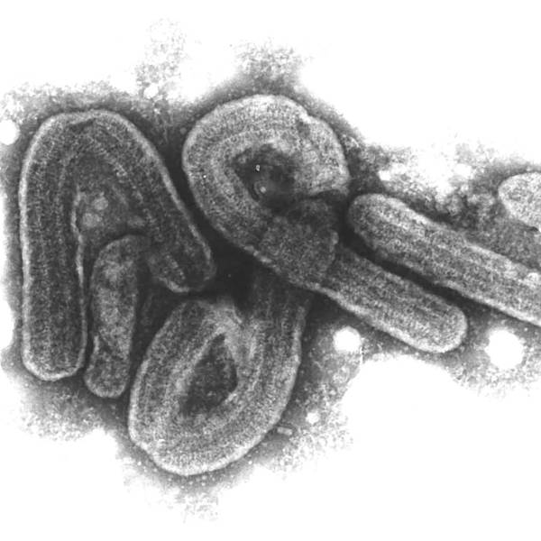 Eine elektronenmikroskopische Aufnahme des Marburg-Virus (undatiertes Handout).