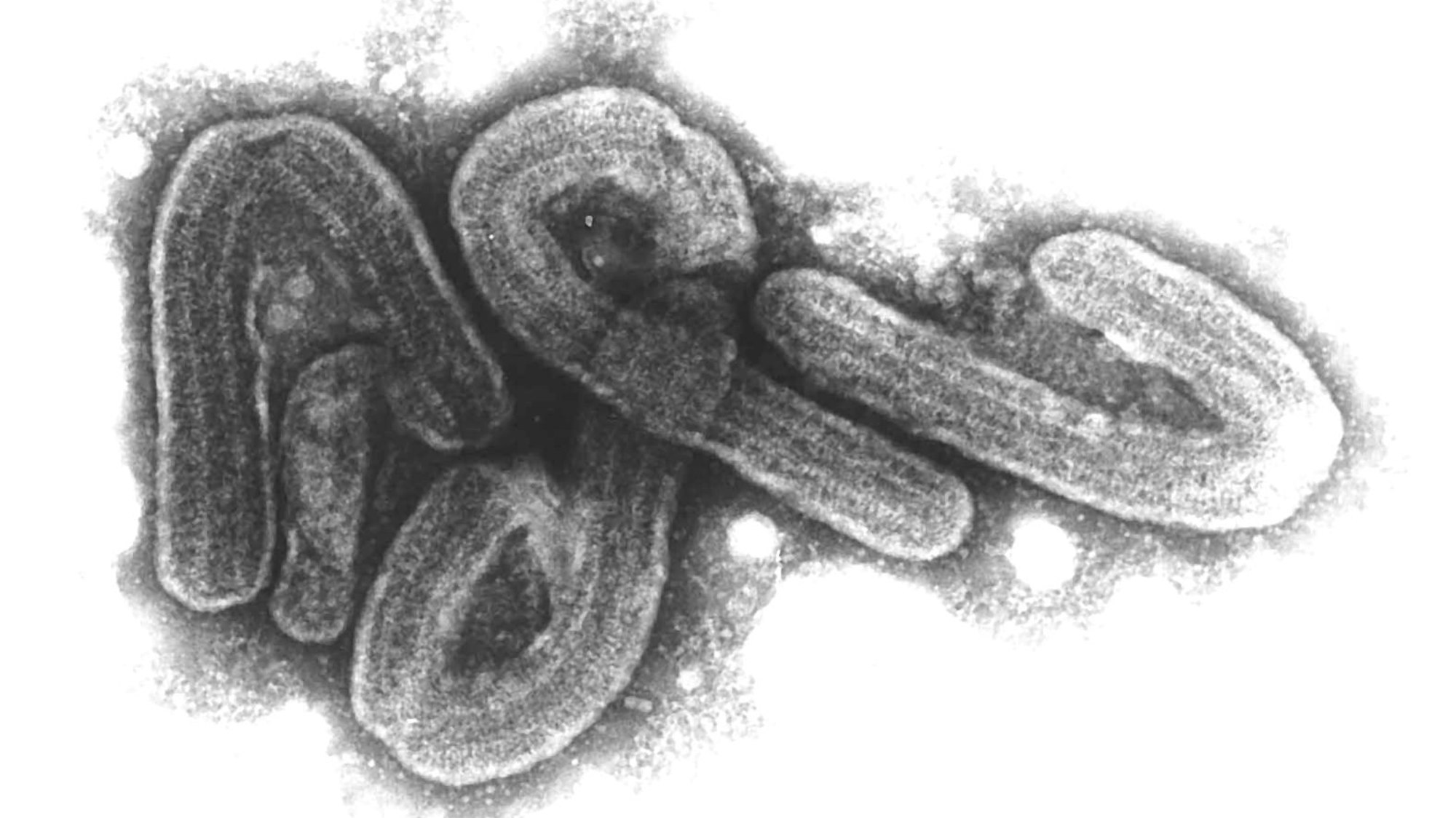 Eine elektronenmikroskopische Aufnahme des Marburg-Virus (undatiertes Handout).
