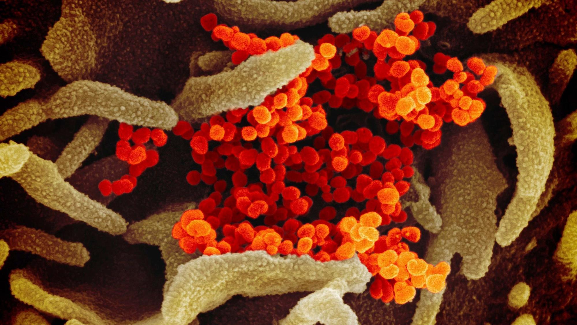 Eine undatierte elektronenmikroskopische Aufnahme des U.S. National Institute of Health zeigt das neuartige Coronavirus (SARS-CoV-2). (Archivbild)