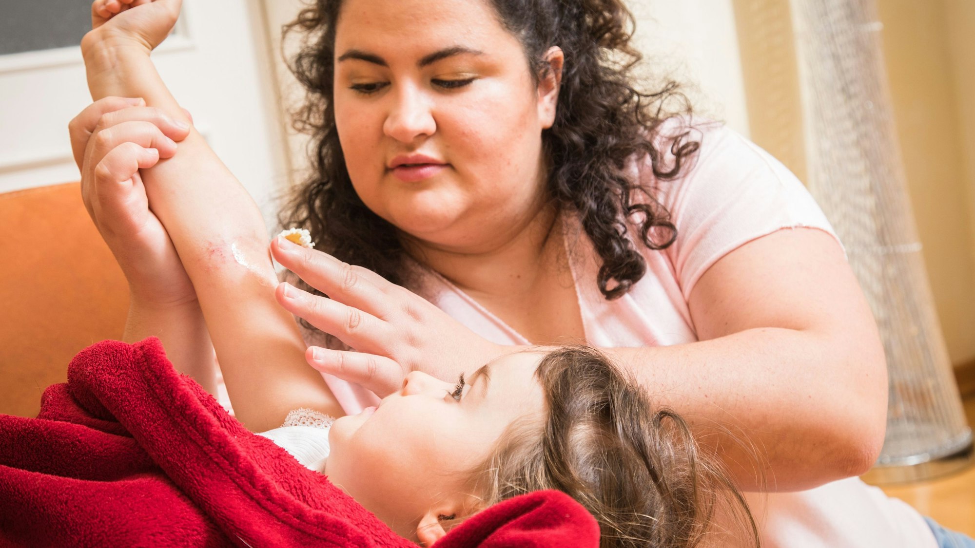 Eine Frau streicht Creme auf die Armbeuge eines Kindes, das Windpocken hat.