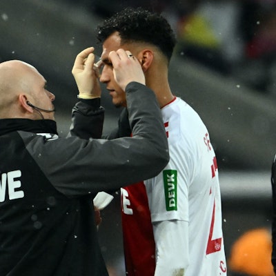 Davie Selke wird vom Mannschaftsarzt im Gesicht versorgt.