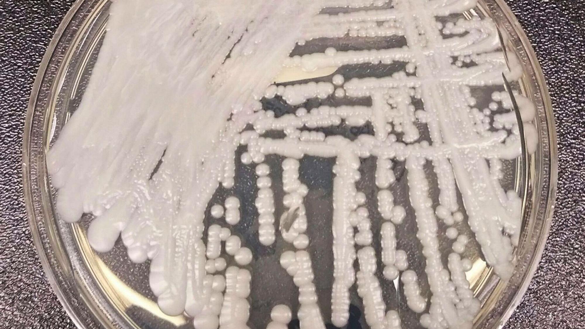 Ein Stamm von Candida auris, kultiviert in einer Petrischale.