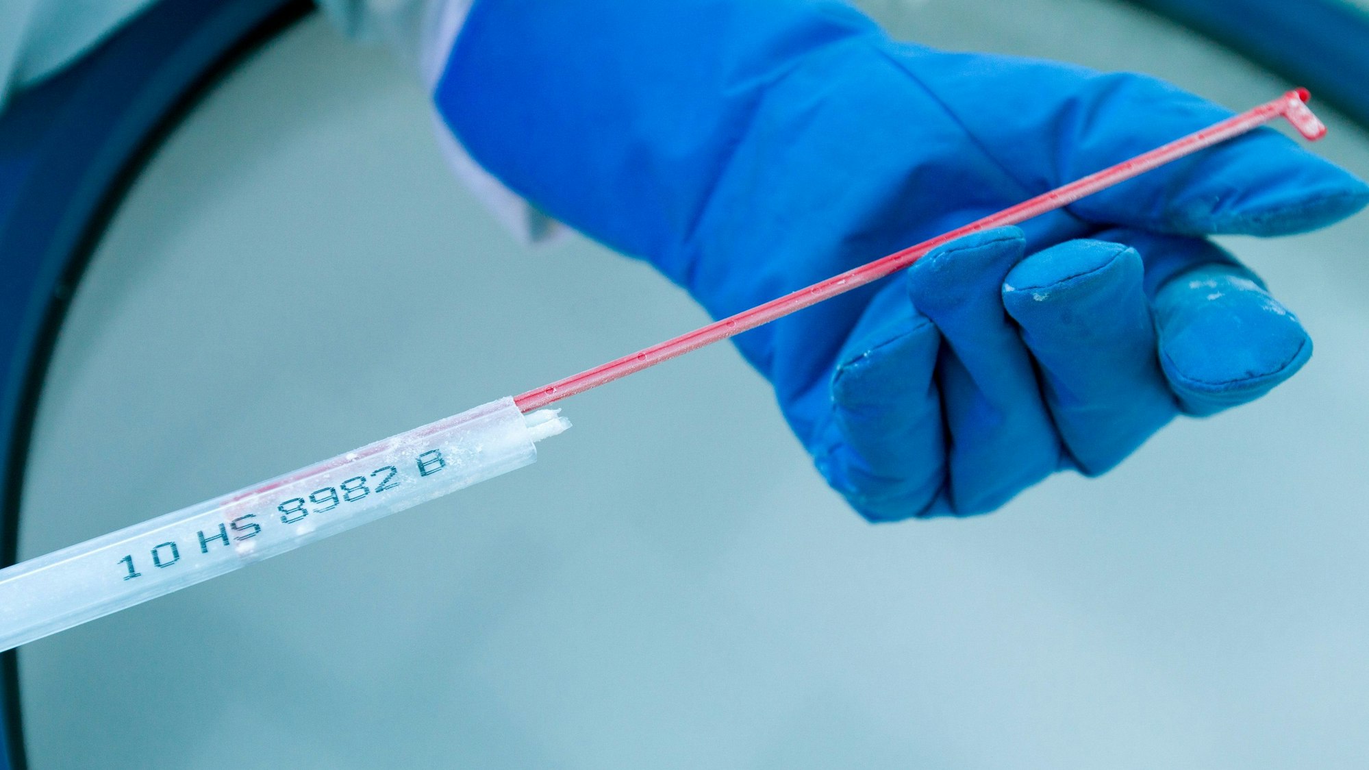 Eine medizinisch-technische Assistentin kontrolliert eine Samenprobe. (Symbolbild).