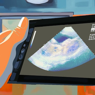 Garfik von zwei Hände, die einen Bildschirm mit Utltraschallaufnahme eines Embryos halten.