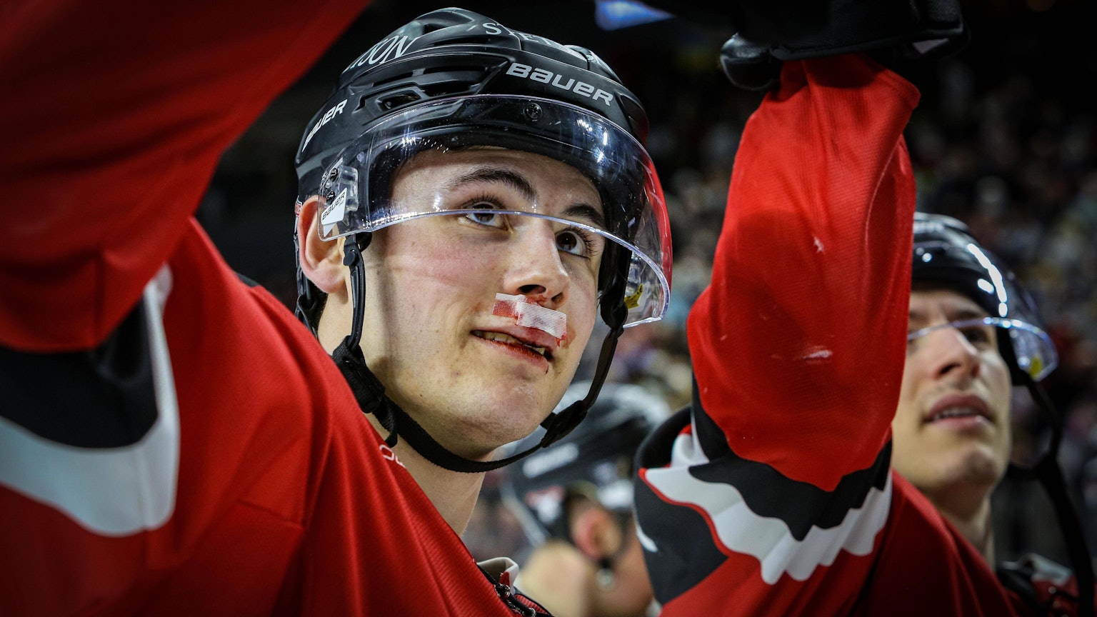 Luis Üffing mit einem Cut im Gesicht.