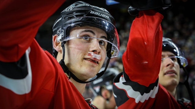 Luis Üffing mit einem Cut im Gesicht.