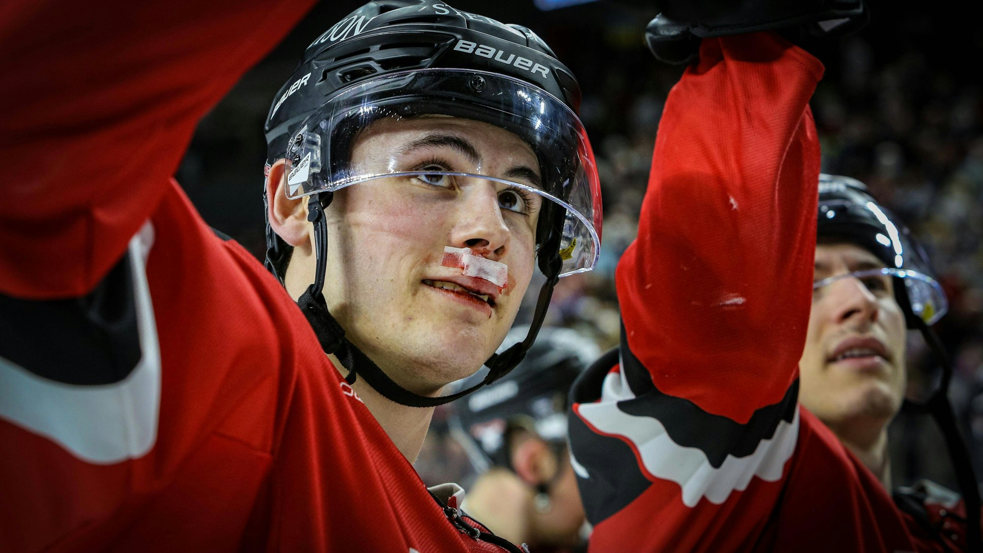 Luis Üffing mit einem Cut im Gesicht.