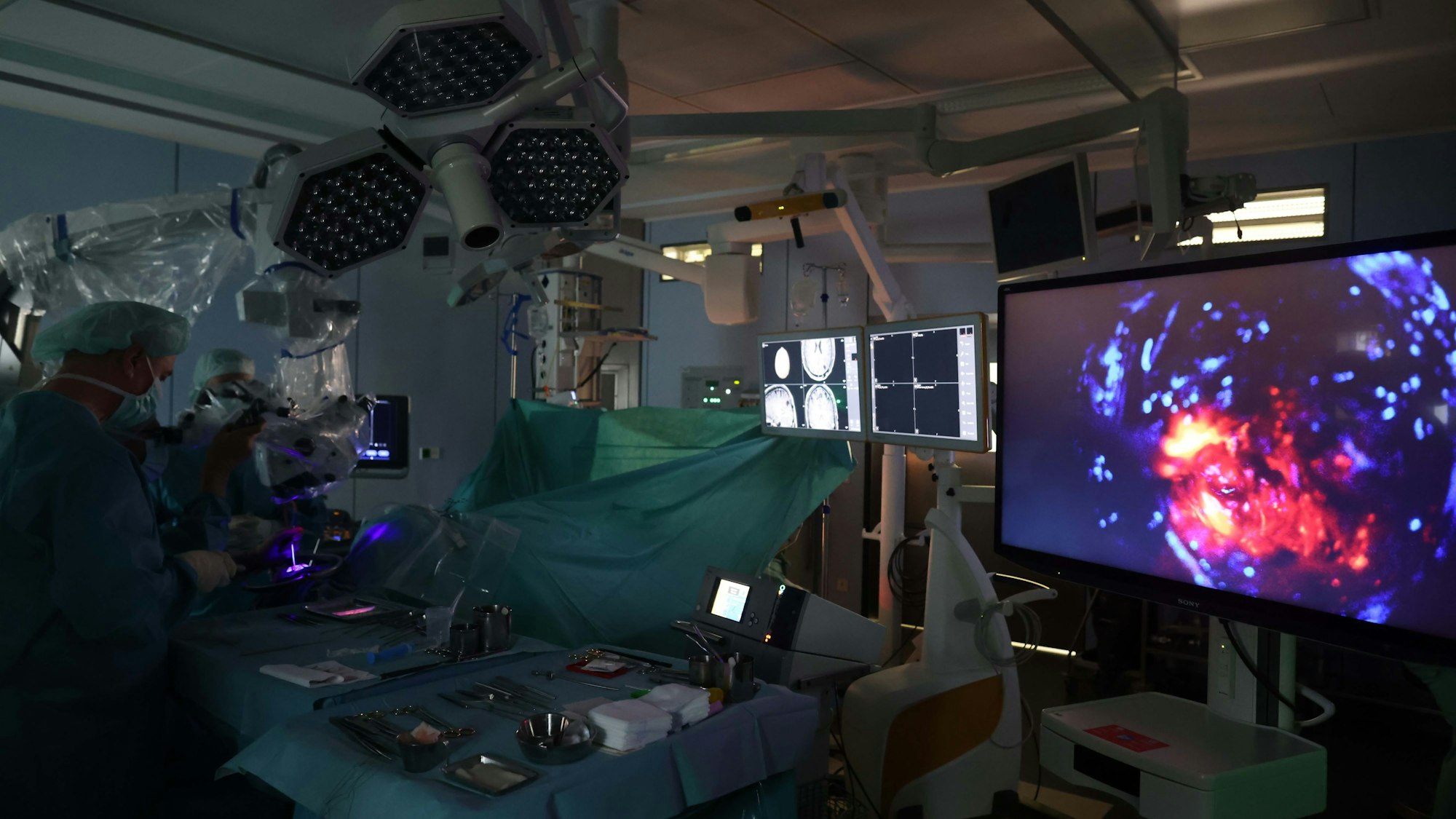 Köln, RSK, Hirn-Tumor-OP, mit Prof Dr Roland Goldbrunner