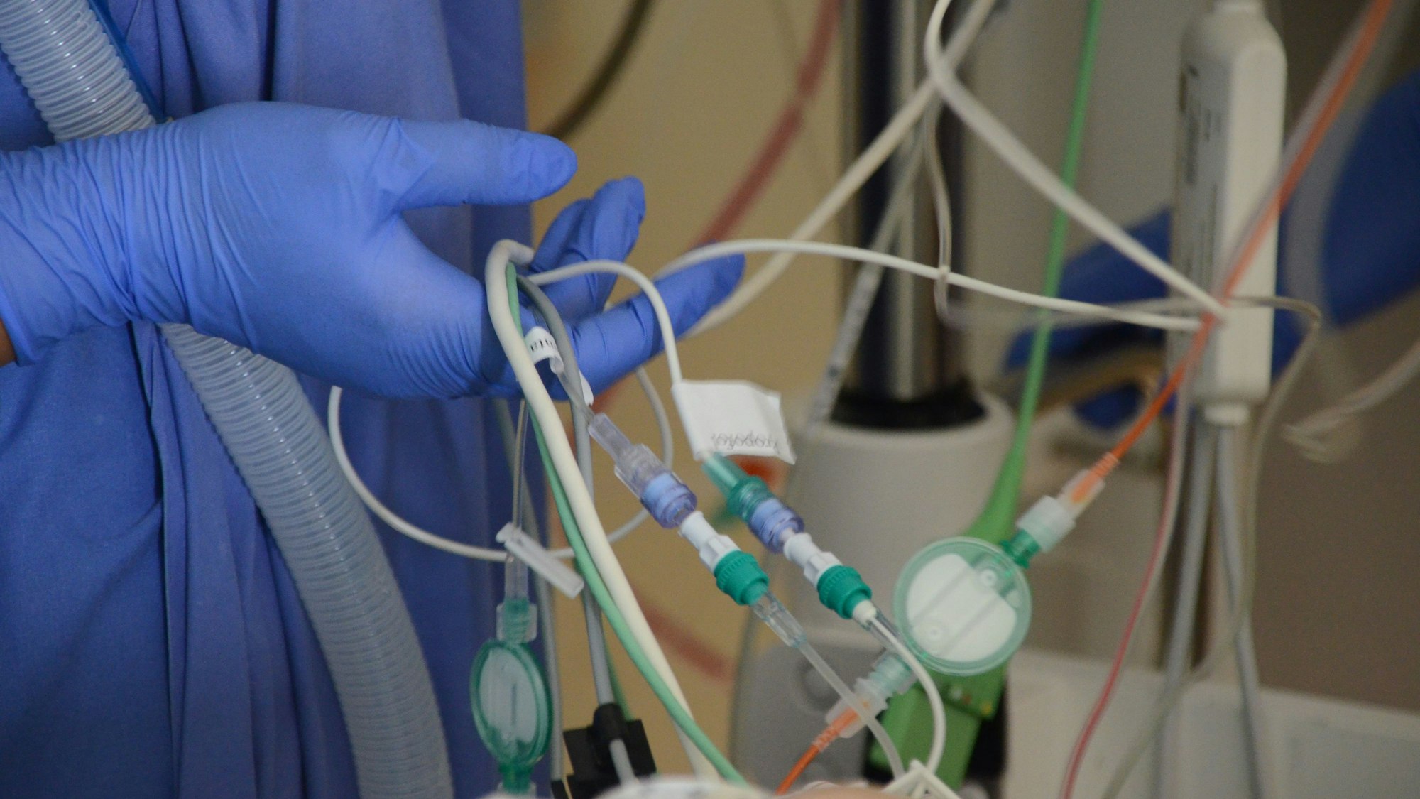 Blick auf eine Vielzahl von Schläuchen und Kabeln, welche das Leben eines Patienten sichern. (Symbolbild)