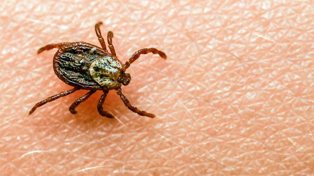 Eine Zecke krabbelt über einen Arm.