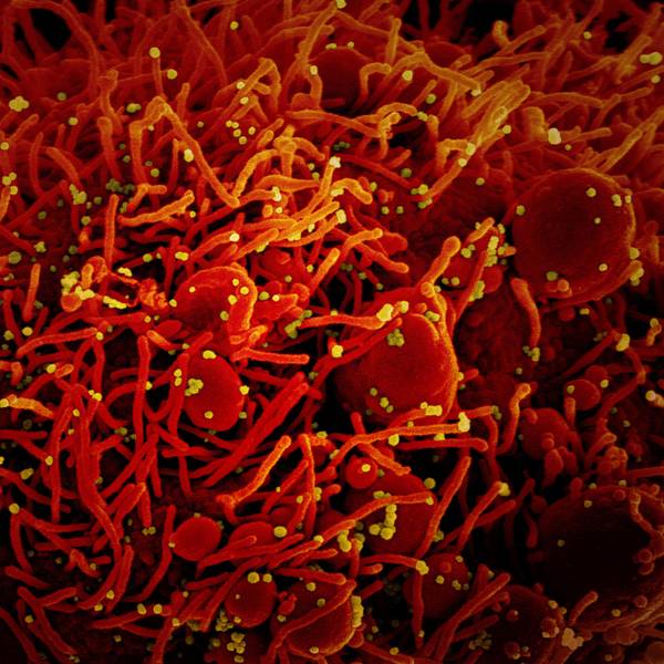 Eine Aufnahme des Coronavirus unter einem Mikroskop, bereitgestellt vom US-Forschungszentrum „National Institute of Allergy and Infectious Diseases“ (NIAID).