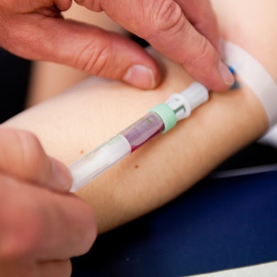 Eine Frau bekommt Blut abgenommen, Nahaufnahme