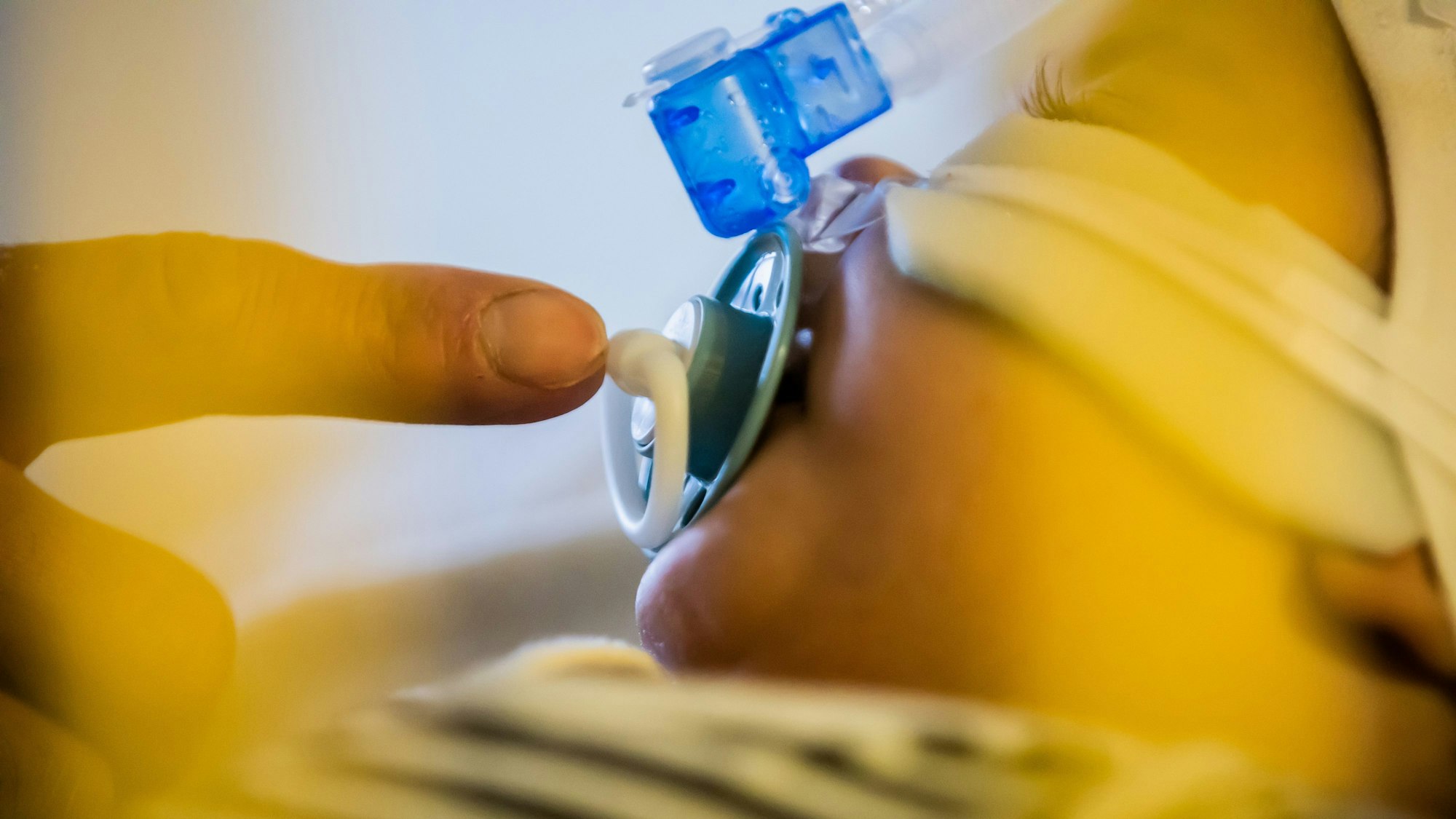 Ein Vater betreut seinen kleinen Sohn, der mit einem Atemwegsinfekt auf der Intensivstation einer Kinderklinik liegt und non-invasiv beatmet wird.