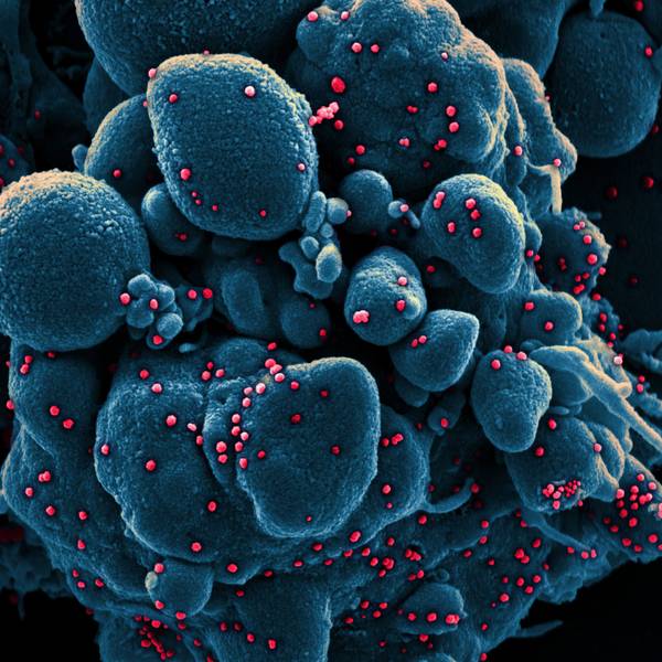 Die Aufnahme zeigt eine Zelle (blau), die mit dem Coronavirus (SARS-CoV-2, rot) infiziert ist. Eine britische Studie deutet nun darauf hin, dass der Wirkstoff Molnupiravir für zusätzliche Mutationen des Virus sorgen könnte. (Archivbild)