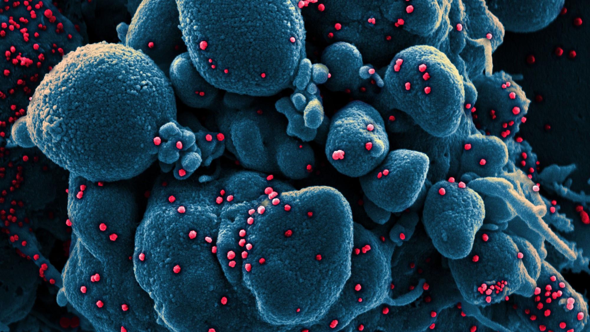 Eine Aufnahme des Coronavirus unter einem Mikroskop, bereitgestellt vom „National Institute of Allergy and Infectious Diseases“ (NIAID).