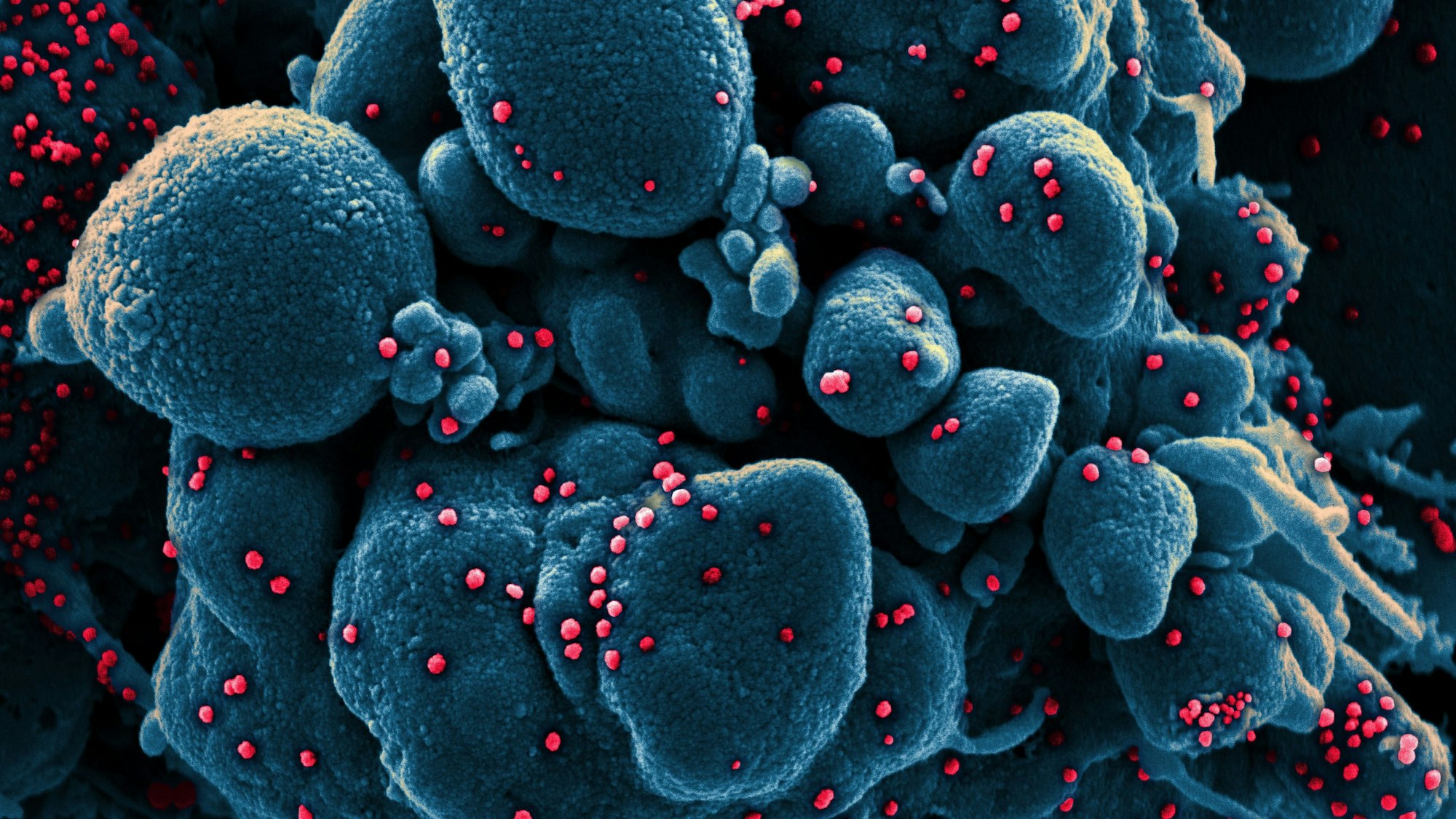Eine Aufnahme des Coronavirus unter einem Mikroskop, bereitgestellt vom „National Institute of Allergy and Infectious Diseases“ (NIAID).