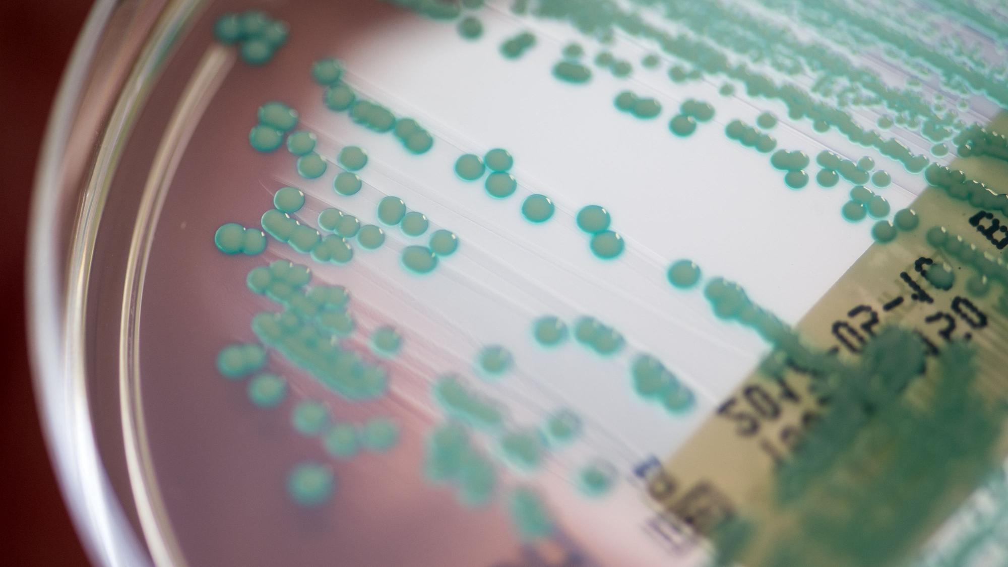Eine Petrischale mit MRSA-Keimen