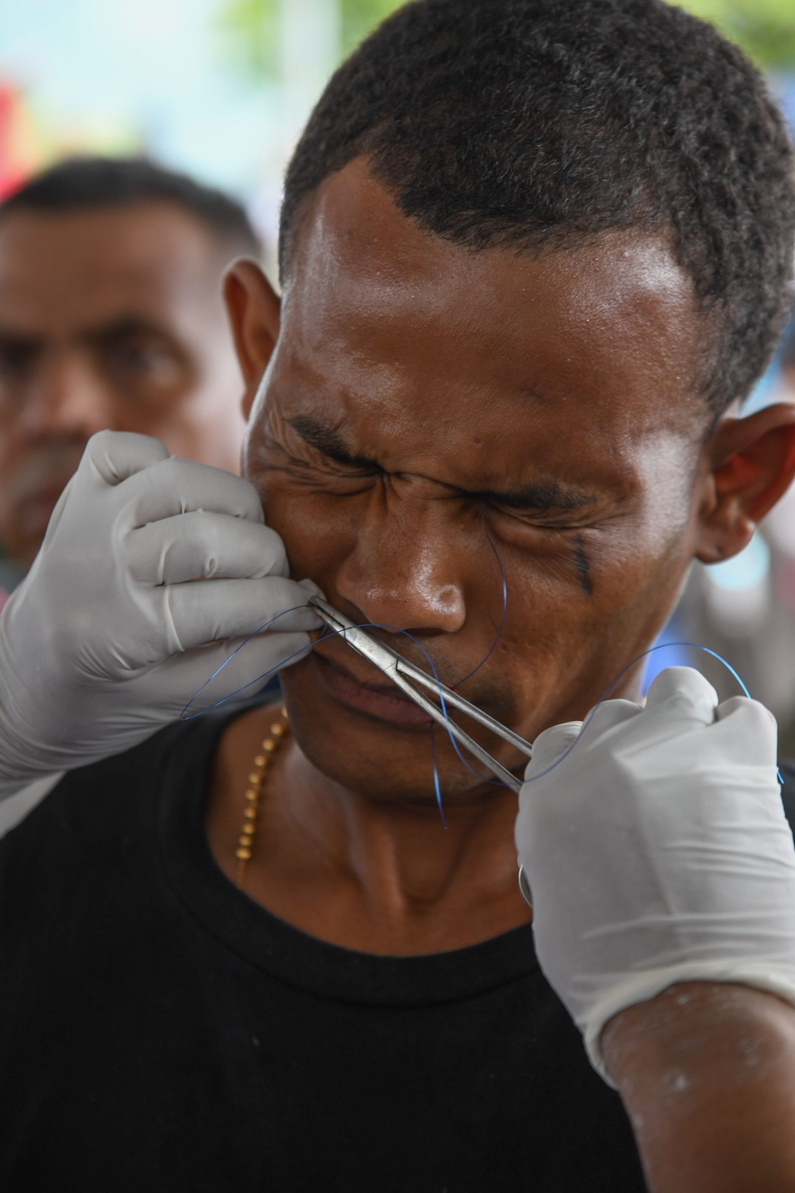 02.11.2023, Mexiko, Huixtla: José Luis Vallejo aus der Dominikanischen Republik lässt sich während eines Protests die Lippen zunähen. In der Gemeinde Huixtla, Chiapas, haben einige Mitglieder einer Migrantenkarawane aus Protest gegen die mangelnde Unterstützung durch das mexikanische Nationale Migrationsinstitut (INM) ihre Lippen zugenäht. Sie fordern unter anderem Einwanderungspapiere, die ihnen die Durchreise durch Mexiko ermöglichen. Foto: Isaac Guzman/dpa +++ dpa-Bildfunk +++