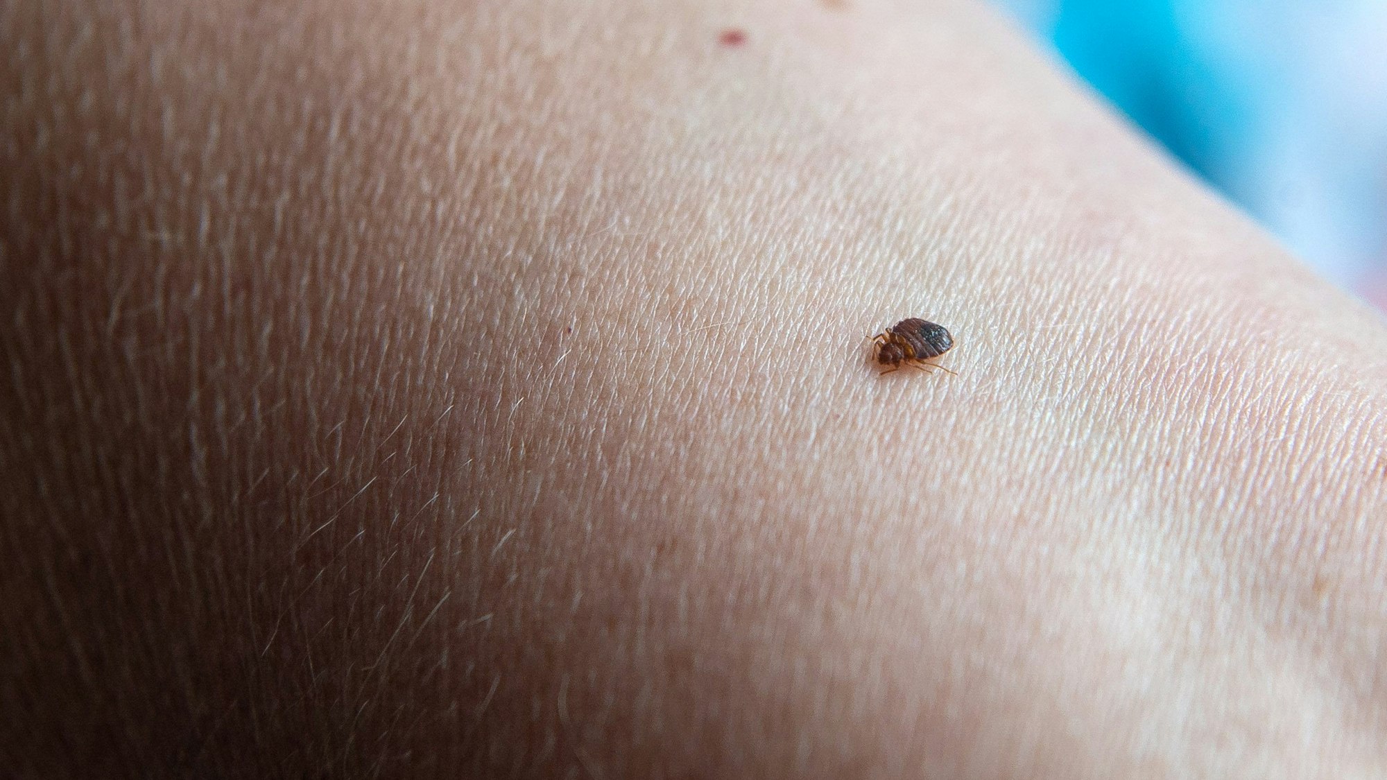 Eine Bettwanze beißt in einen Arm (Symbolbild). In Frankreich gibt es Aufregung um die Verbreitung von Bettwanzen. Vor Olympia rüsten einige Hotels nun auf.