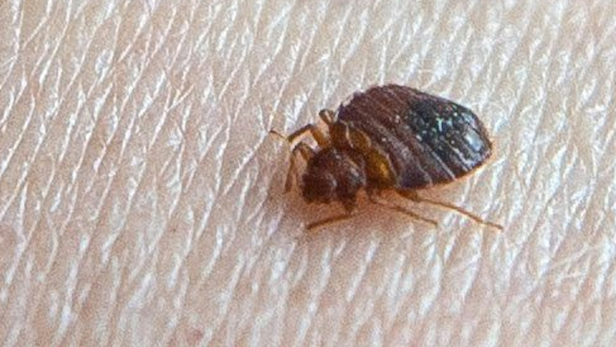 Eine Bettwanze beißt in einen Arm.