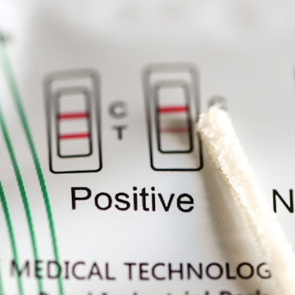 Ein Antigentest zum Nachweis von Covid-19 zum Selbsttest gibt Hilfe zum Auswerten des Ergebnisses.