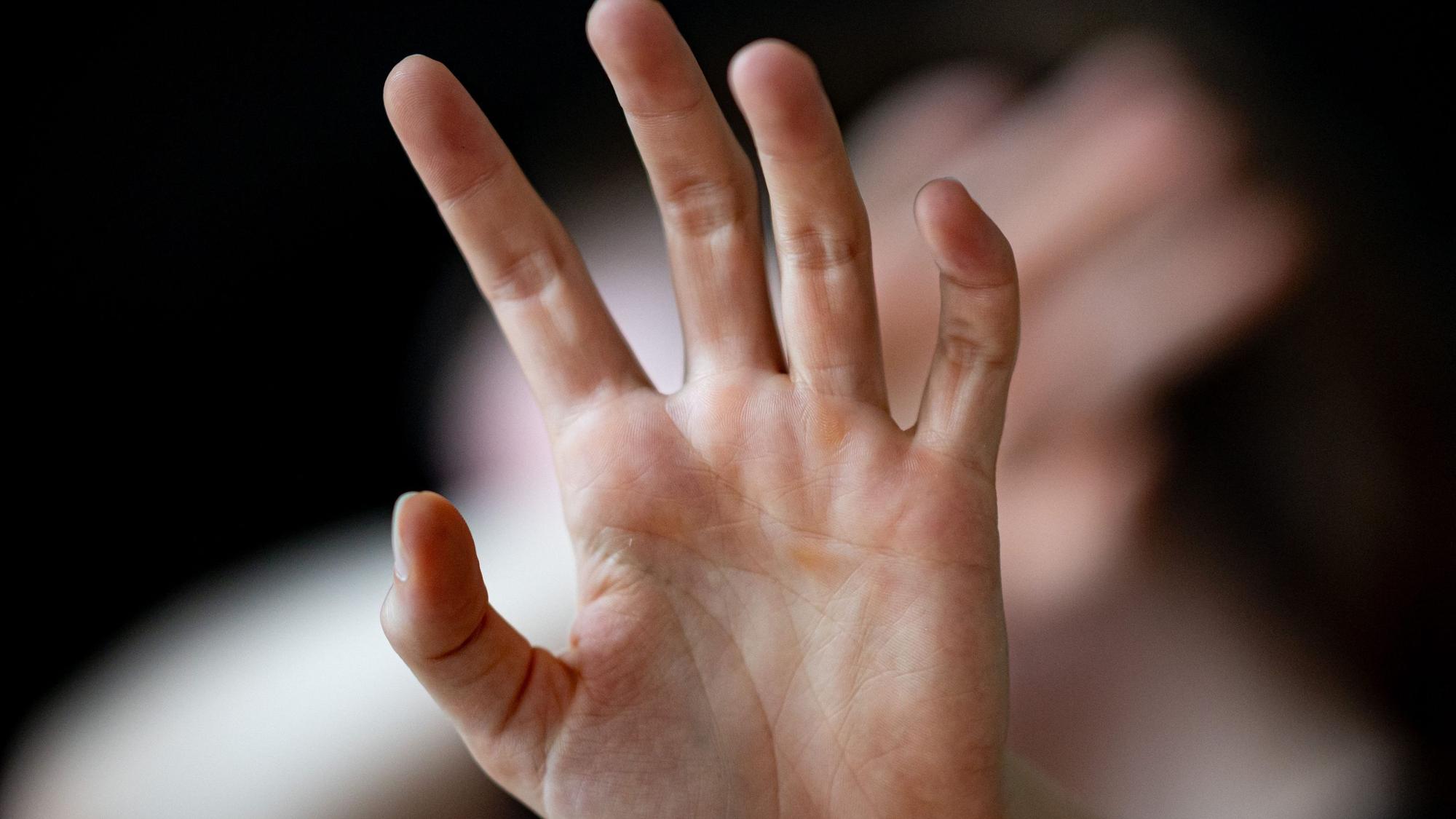 Eine Frau hält ihre Hände vor das Gesicht.