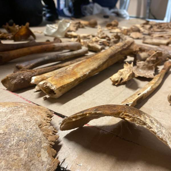Mehr als 100 Jahre alte, menschliche Knochen sind auf einem Tisch ausgebreitet. Sie waren bei Bauarbeiten in Niederelvenich gefunden worden.