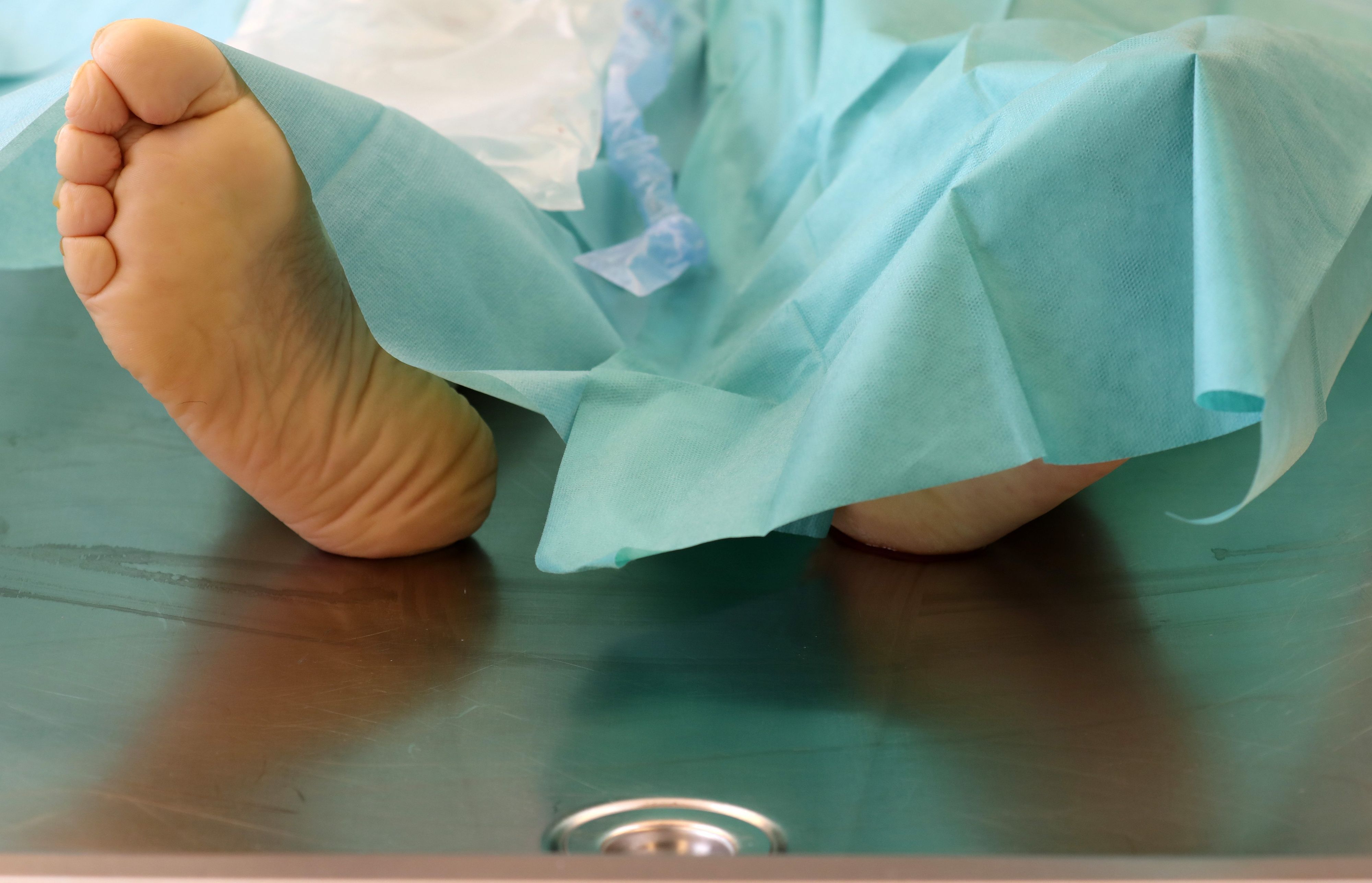 Ein Verstorbener liegt in der Pathologie.
