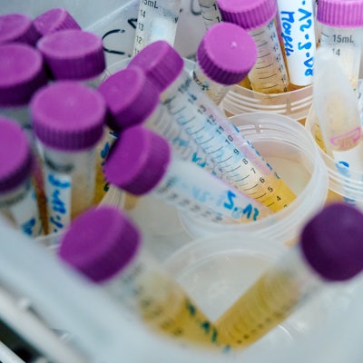 In den Proben von zahlreichen Kleinkindern aus Nordrhein-Westfalen konnte der Weichmacher Di-n-hexyl-Phthalat (DnHexP), der die Fruchtbarkeit schädigen soll, nachgewiesen werden.