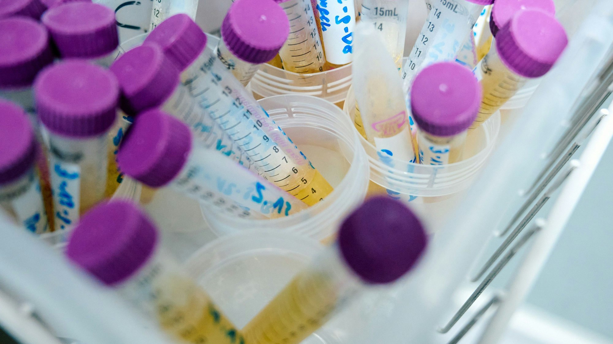 In den Proben von zahlreichen Kleinkindern aus Nordrhein-Westfalen konnte der Weichmacher Di-n-hexyl-Phthalat (DnHexP), der die Fruchtbarkeit schädigen soll, nachgewiesen werden.