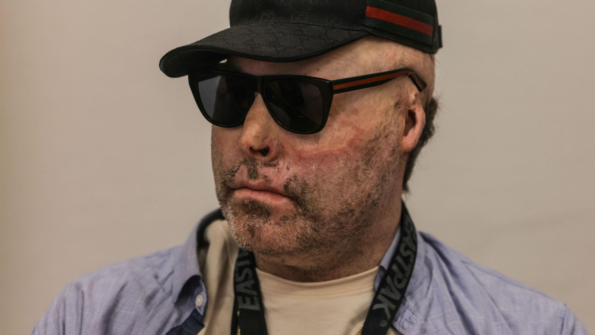18.01.2024, Nordrhein-Westfalen, Köln: Der angeklagte Dr. Knarf (Niko Brenner) sitzt im Landgericht. Mit einem weiteren Angeklagten soll der Rapper in einem Kölner Mehrfamilienhaus Butan-Hasch-Öl hergestellt haben.