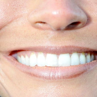 Ein lachender Mund einer Frau ist am 19.09.2010 in München (Oberbayern) auf dem Oktoberfest zu sehen.