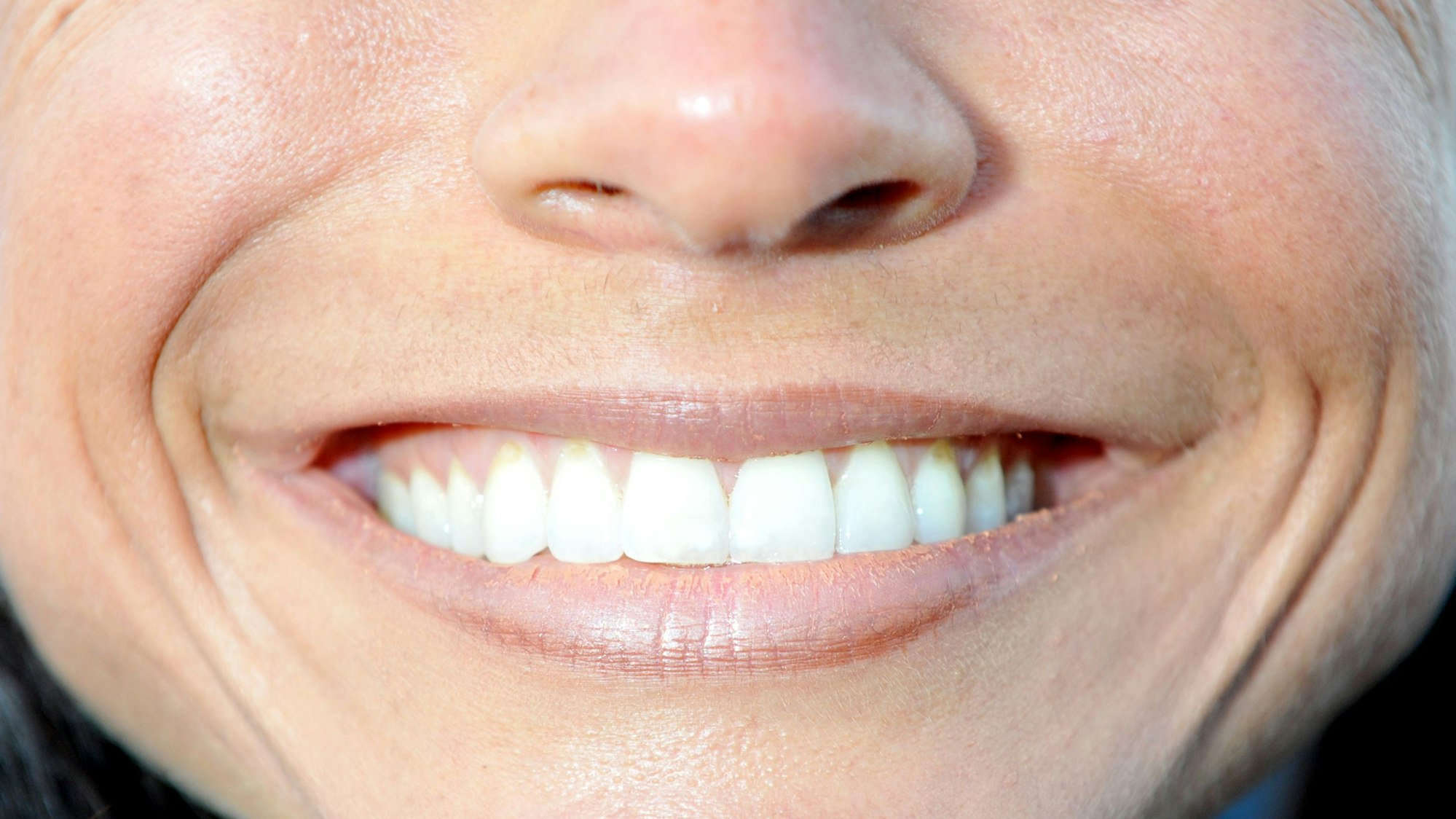 Ein lachender Mund einer Frau ist am 19.09.2010 in München (Oberbayern) auf dem Oktoberfest zu sehen.