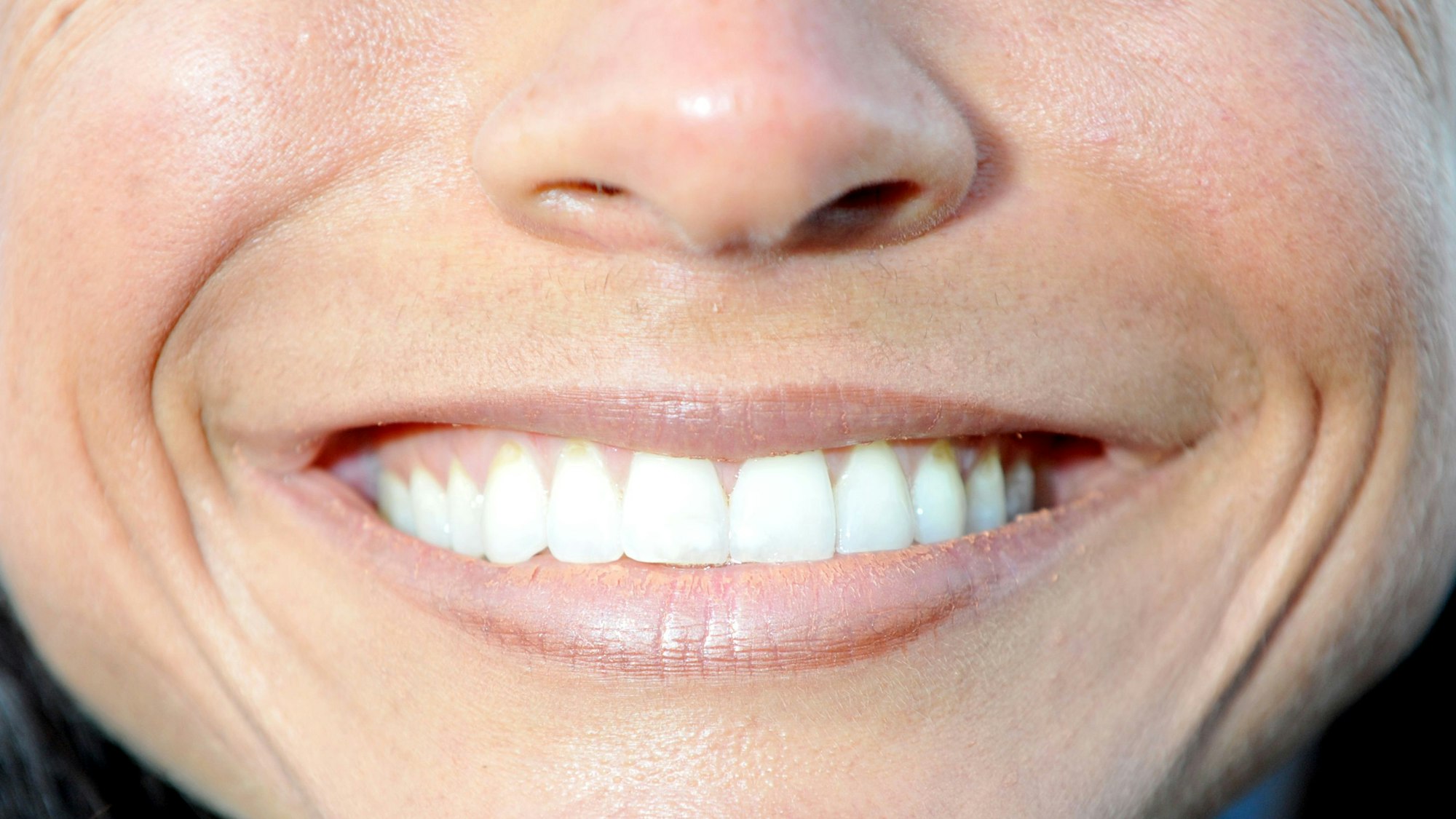 Ein lachender Mund einer Frau ist am 19.09.2010 in München (Oberbayern) auf dem Oktoberfest zu sehen.