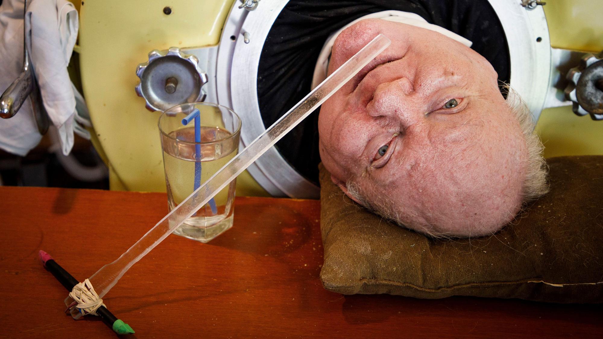 Paul Alexander blickt aus seiner eisernen Lunge in seinem Haus. (Archivbild)