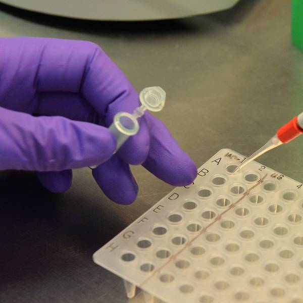 In einem Labor werden Blutproben auf das Virus H5N1, auch bekannt als Vogelgrippe, getestet. Im US-Bundestaat Texas hat sich ein Mann mit der Krankheit infiziert.