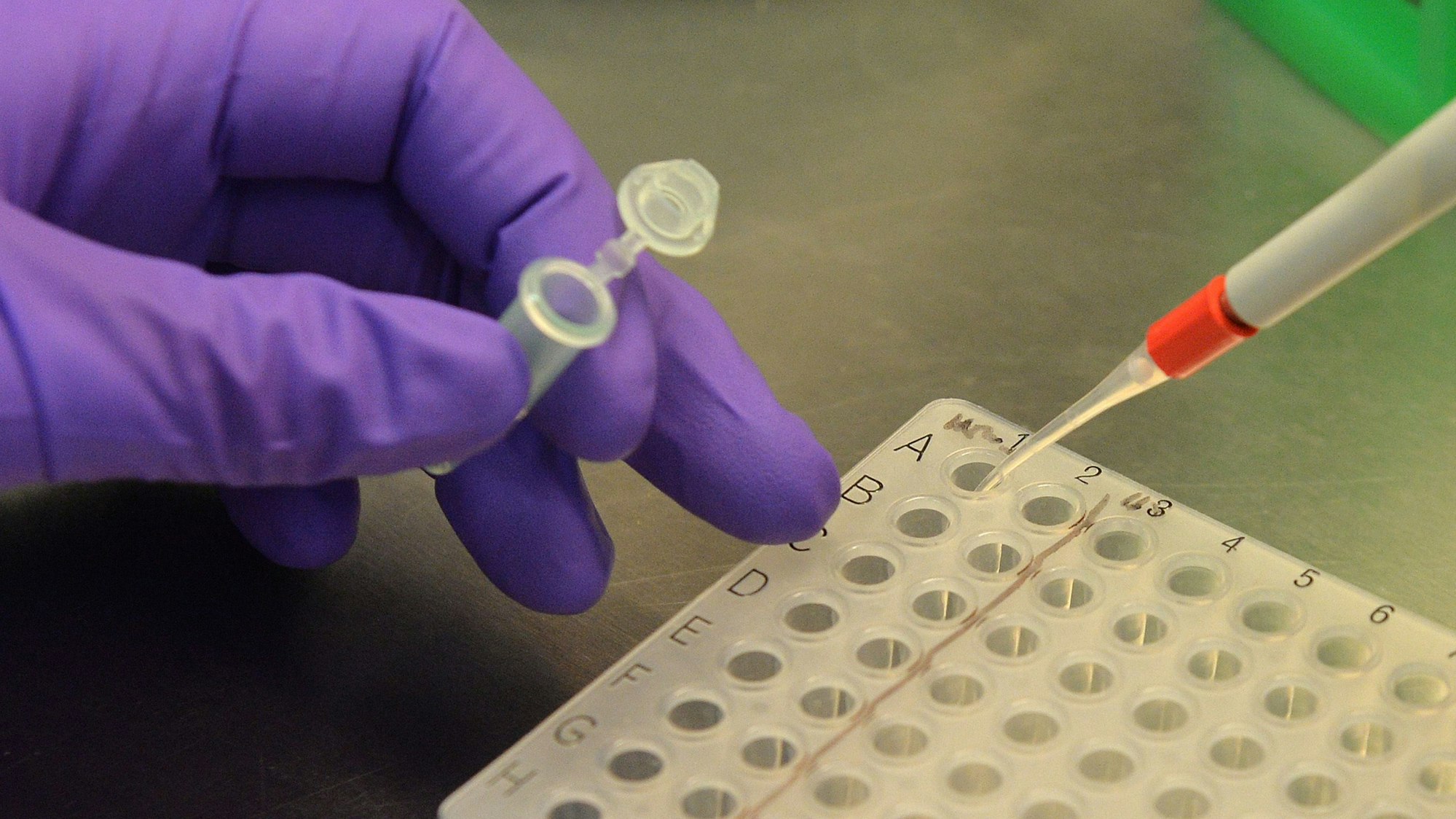 In einem Labor werden Blutproben auf das Virus H5N1, auch bekannt als Vogelgrippe, getestet. Im US-Bundestaat Texas hat sich ein Mann mit der Krankheit infiziert.