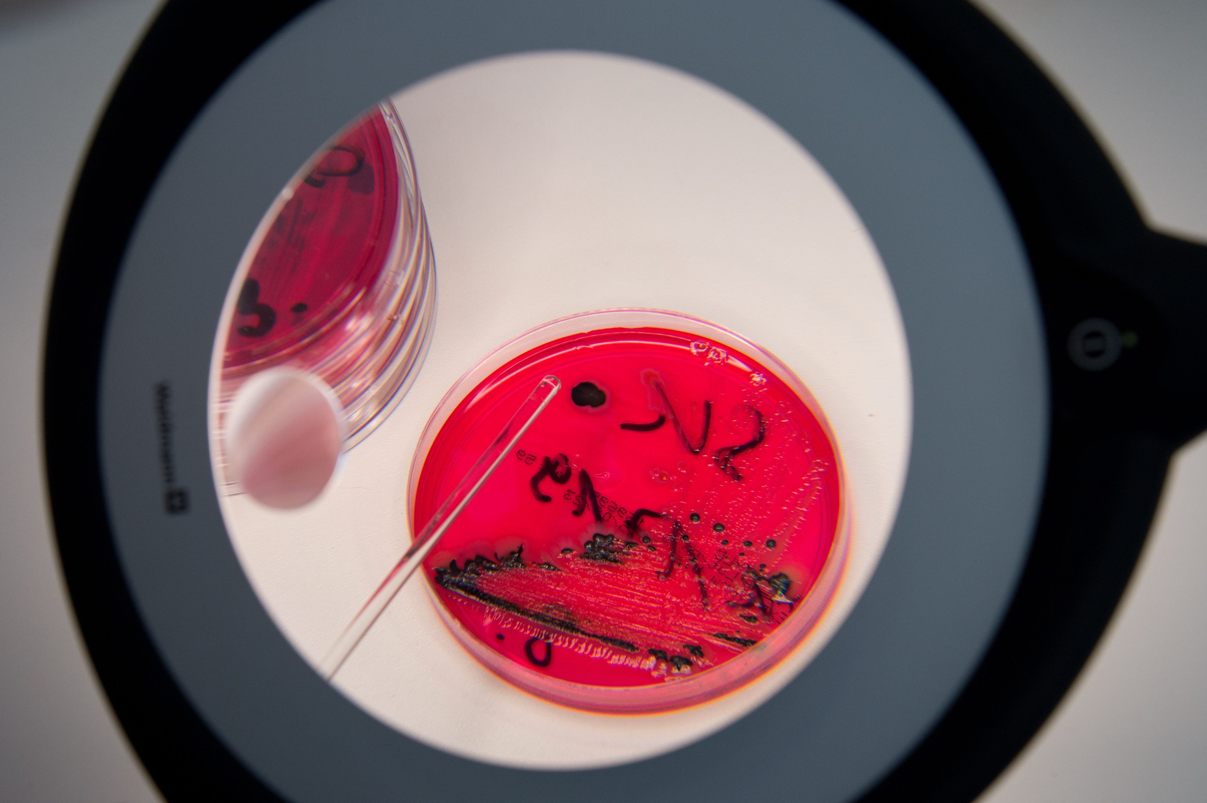 In der Landesuntersuchungsanstalt für das Gesundheits- und Veterinärwesen Sachsen (LUA) werden in einem Labor der LUA Salmonellen in einer Petrischale gezeigt.