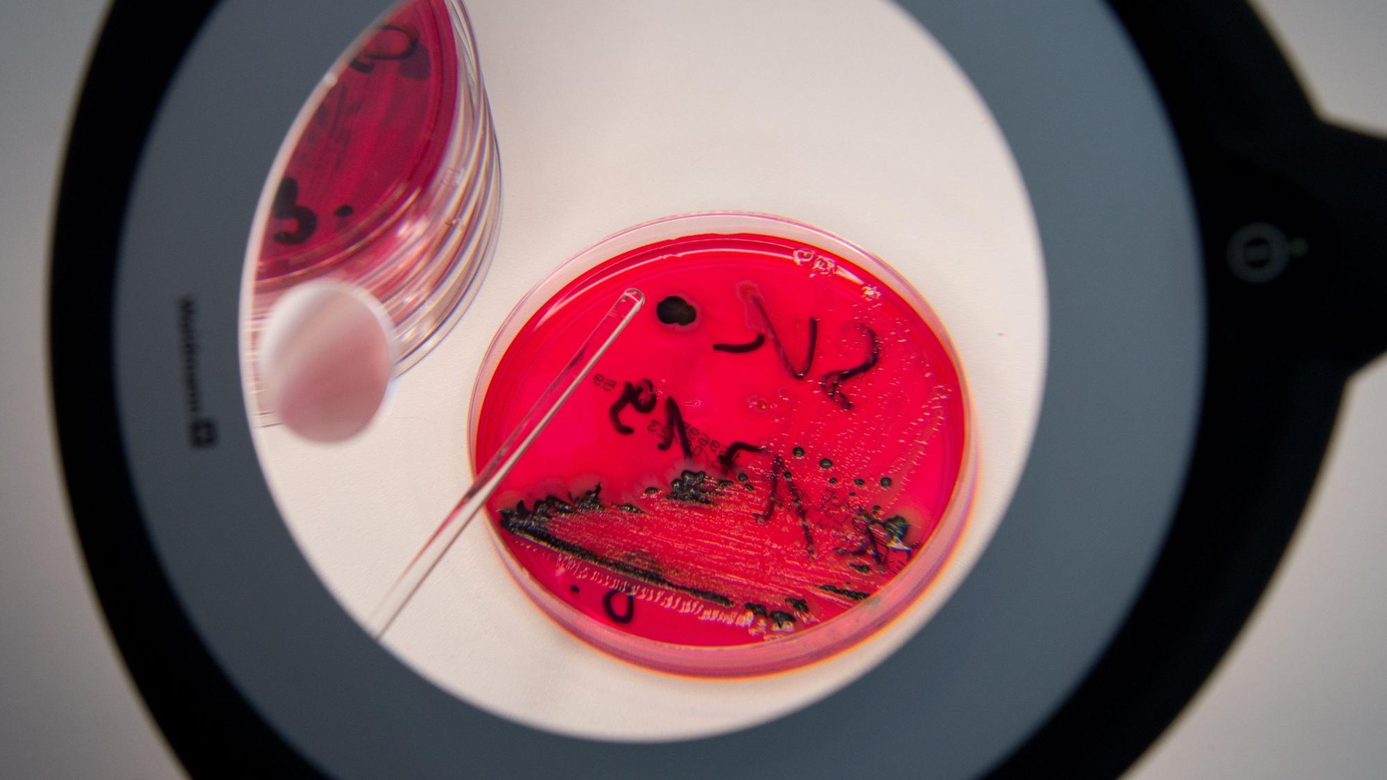 In der Landesuntersuchungsanstalt für das Gesundheits- und Veterinärwesen Sachsen (LUA) werden in einem Labor der LUA Salmonellen in einer Petrischale gezeigt.