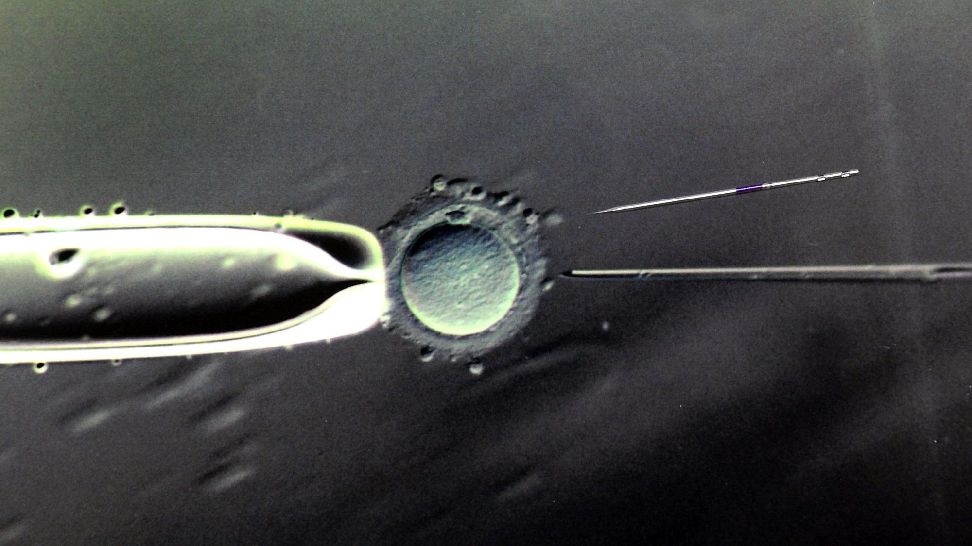 ARCHIV - Im Biologischen Labor des Zentrums für Reproduktionsmedizin an der Universitätsfrauenklinik in Leipzig ist eine 80- bis 100-fache Vergrößerung der Befruchtung einer Eizelle mit einer Injektionspipette und eine darüber liegende Injektionspipette mit einem Durchmessser von 5 Mikrometer in Originalgröße zu sehen, aufgenommen am 17.03.2011.