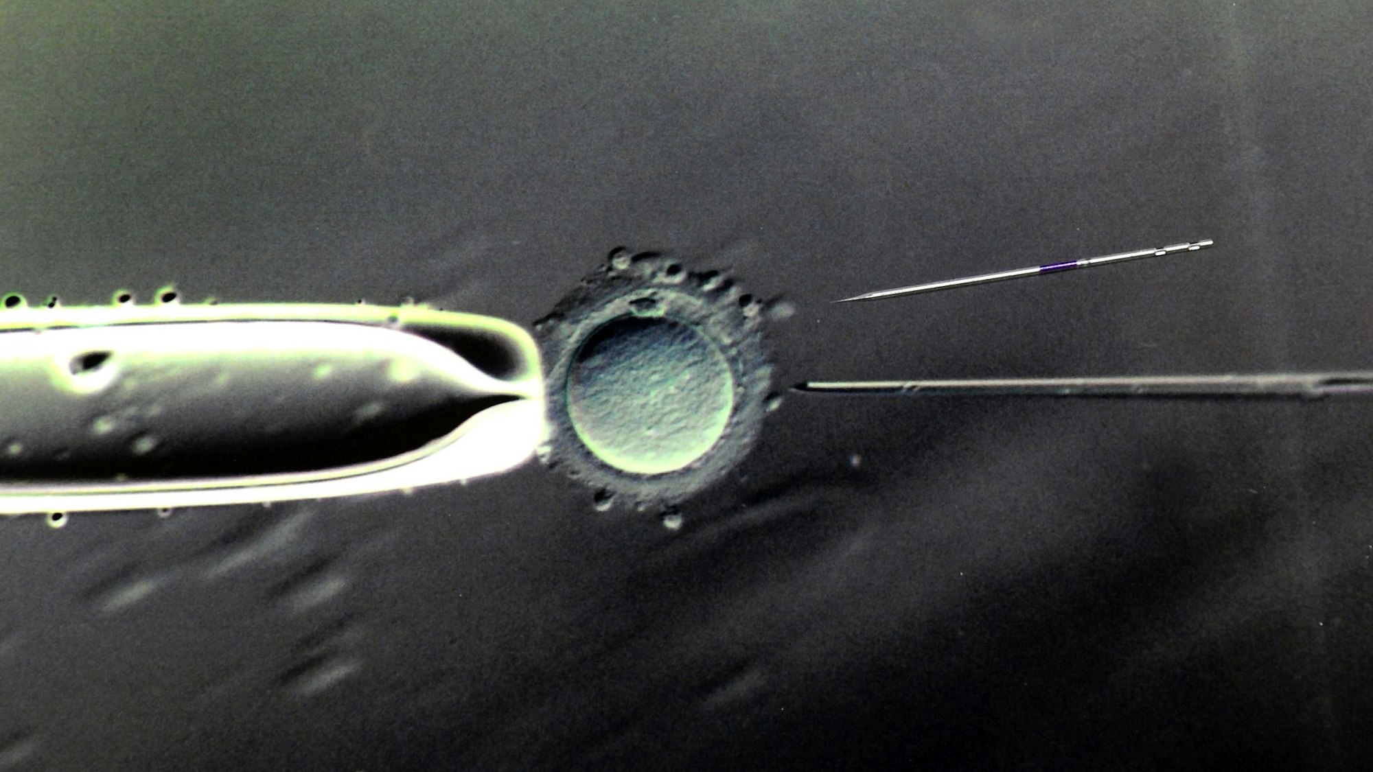 ARCHIV - Im Biologischen Labor des Zentrums für Reproduktionsmedizin an der Universitätsfrauenklinik in Leipzig ist eine 80- bis 100-fache Vergrößerung der Befruchtung einer Eizelle mit einer Injektionspipette und eine darüber liegende Injektionspipette mit einem Durchmessser von 5 Mikrometer in Originalgröße zu sehen, aufgenommen am 17.03.2011.