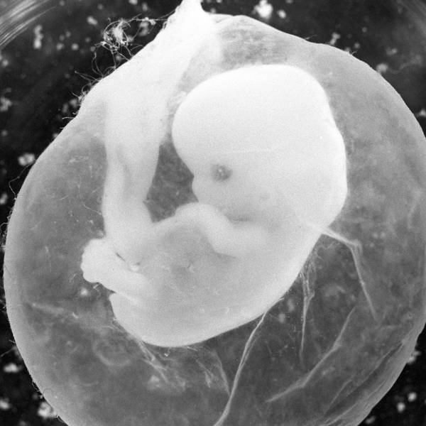 Sieben Wochen alt ist dieser Embryo in seiner Fruchtblase, von der achten Woche an sprechen Mediziner von einem Fötus.