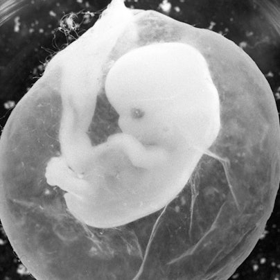Sieben Wochen alt ist dieser Embryo in seiner Fruchtblase, von der achten Woche an sprechen Mediziner von einem Fötus.
