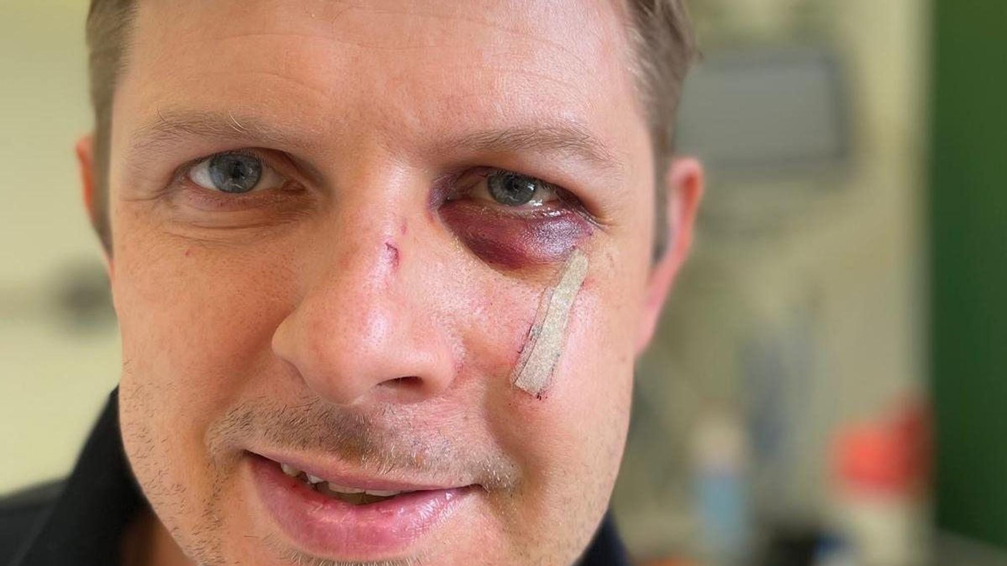 Der SPD-Europaabgeordnete Matthias Ecke hat sich mit einem Dank aus dem Krankenhaus gemeldet.