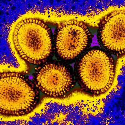 Eine Mikroskopaufnahme des Vogelgrippe-Erregers H5N1.