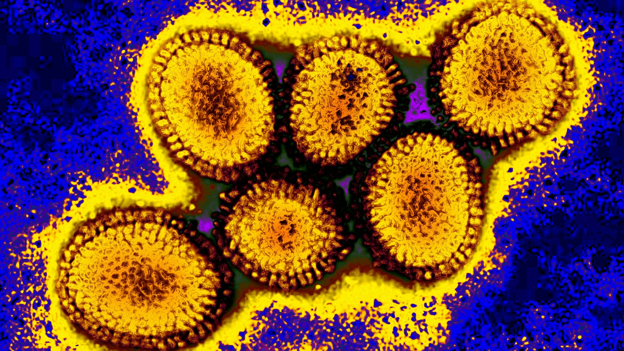 Eine Mikroskopaufnahme des Vogelgrippe-Erregers H5N1.